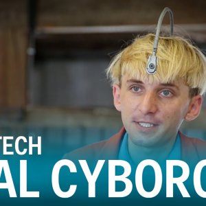 BIO+BODY-HACKER+DO-IT-YOURSELF+CYBORG: This real-life Cyborg has an antenna implanted into his skull (US 2015)