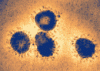 corona1.gif