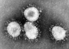 so-sieht-das-coronavirus-wirklich-aus-elektronenmikroskop.webp